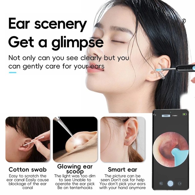 EarCamera - HD Oor Camera Kit